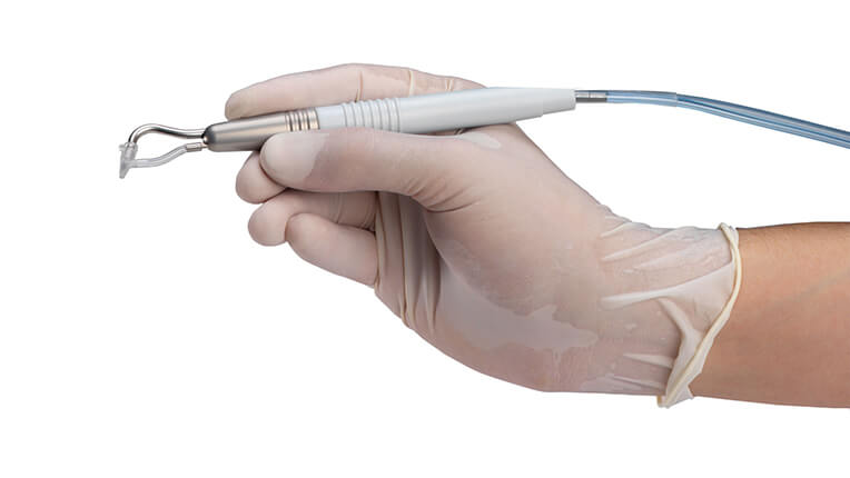 Image representing Ultrasonic Cleaning / Air Polishing