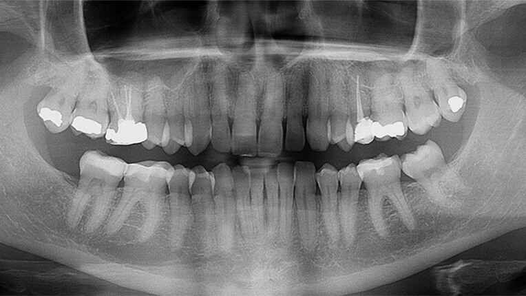 Image representing Digital Imaging & X-Rays